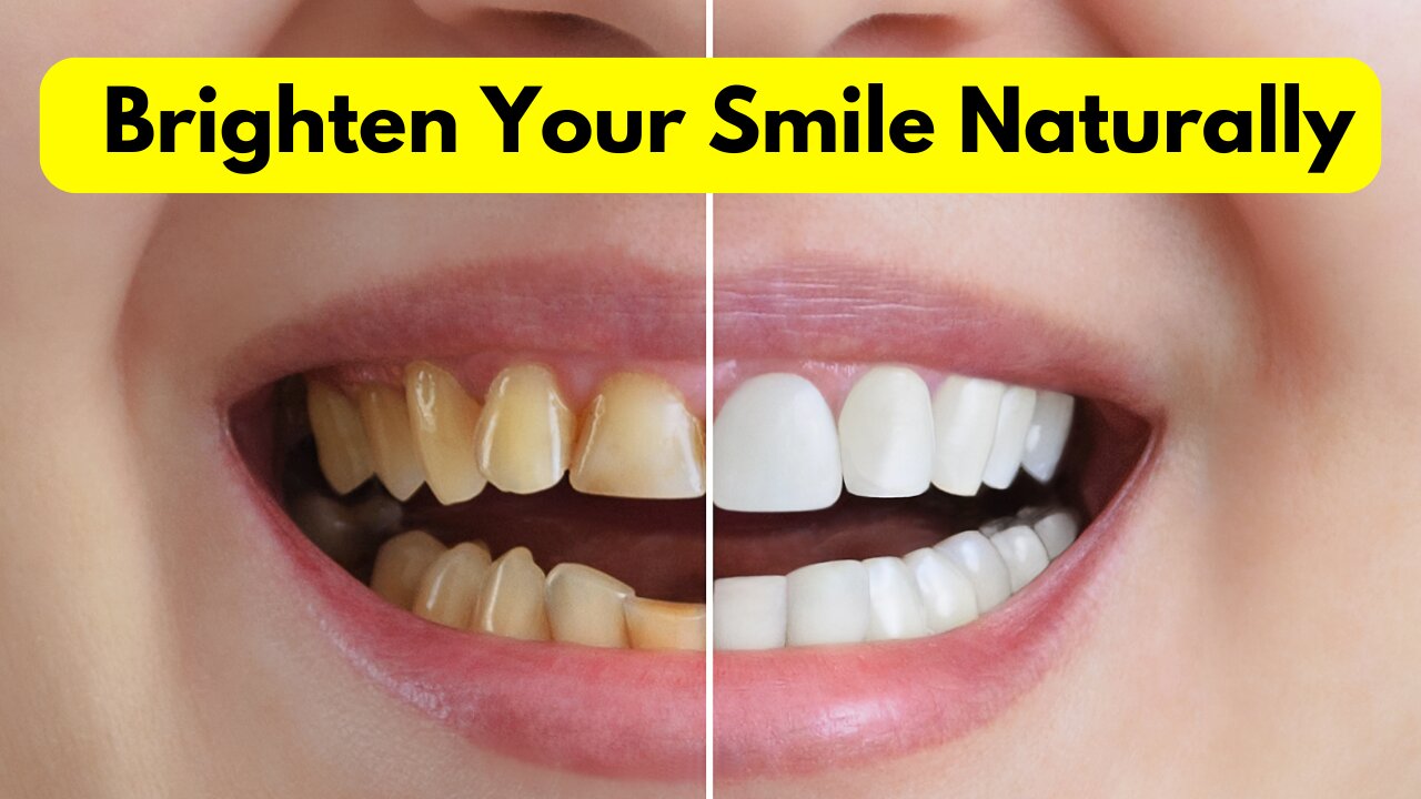 Say Goodbye to Yellow Teeth with Home Remedies!