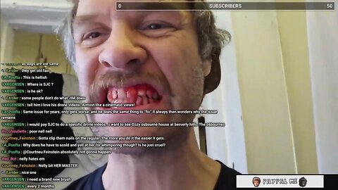 SJC brushes with no water or toothpaste causing his gums to immediately start bleeding