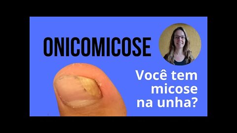 Tudo sobre onicomicose / micose de unha / unheira #108