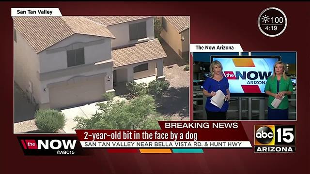 Child bitten in face by dog in San Tan Valley