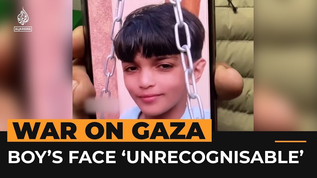 Injured Palestinian boy in Gaza no longer recognises his own face | Al Jazeera News Feed