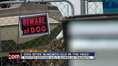 Toddler transported to trauma center after being bitten in head by family dog in Spring Hill