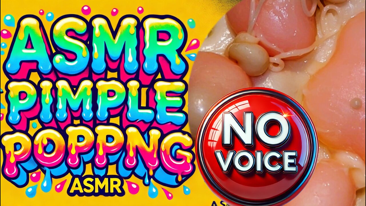 Mochi Pimple Popping no voice ASMR / Cat Paw🐾 / Men power 💪 #pimplepopping