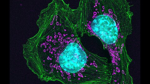 Luciferase-Modified Magnetic Nanoparticles In Medical Imaging