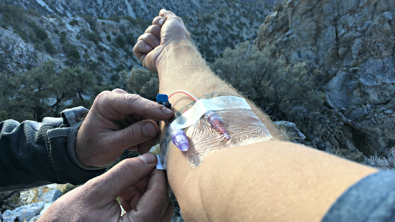 Starting an IV Catheter