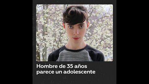 Hombre de 35 años luce como un adolescente