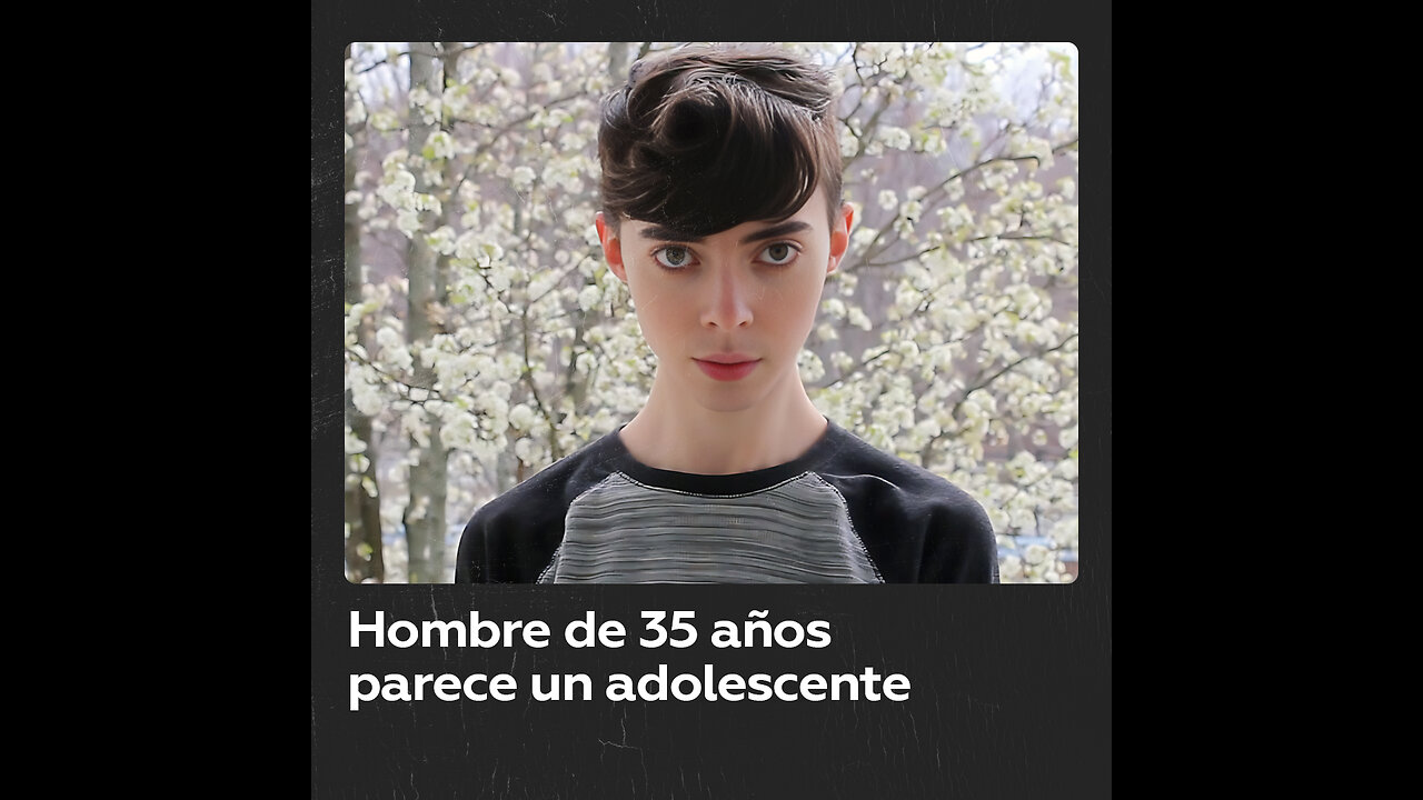 Hombre de 35 años luce como un adolescente