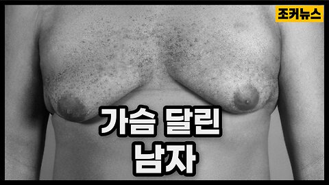 씨를 말리는 또 하나의 인구감축법 Male sperm reduction