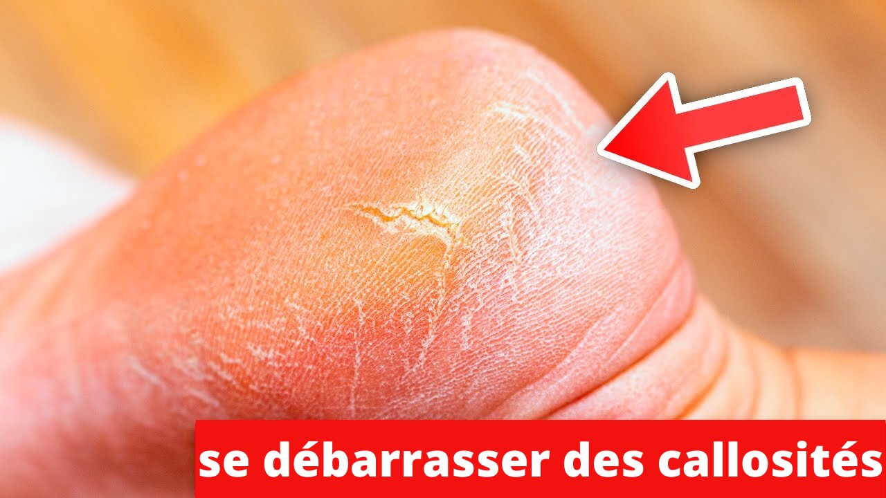 6 signes courants de carence en vitamines et comment les corriger