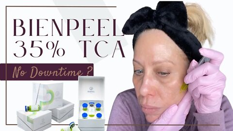 BienPeel 35% TCA peel - No downtime 🤗