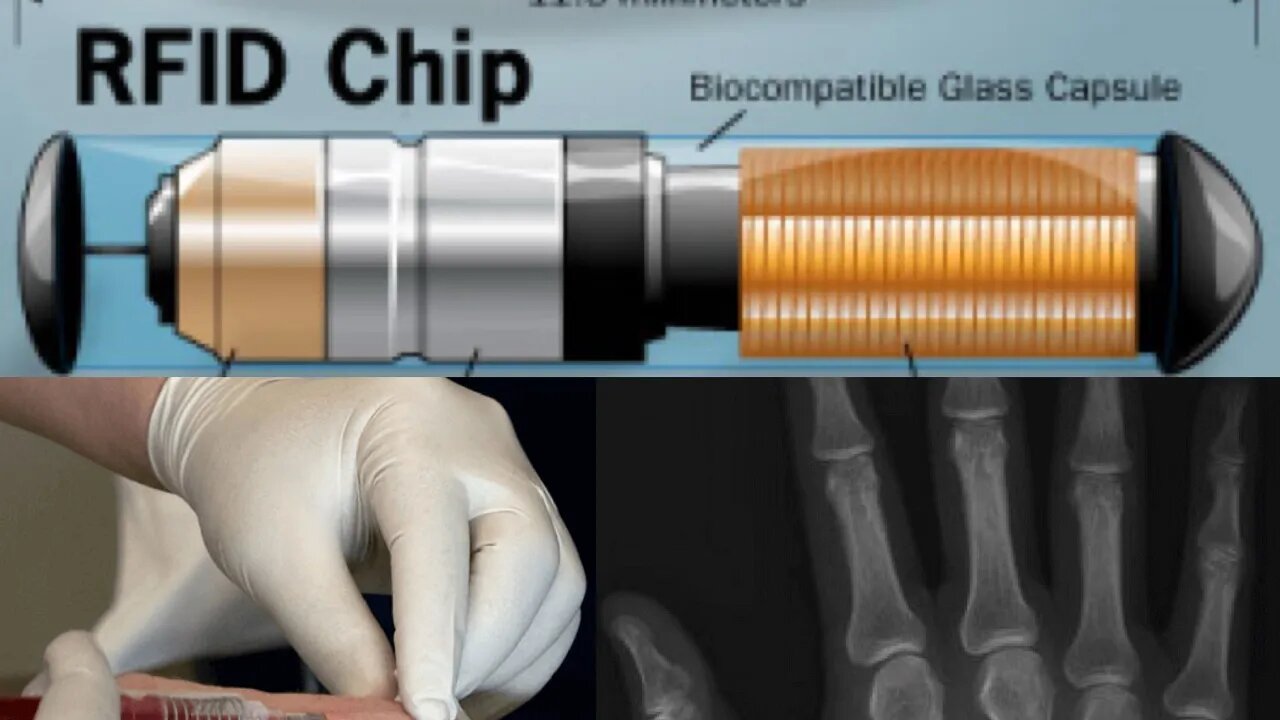Reiterating on the point of the MOTB is not the VAXXINE it is the MIRCOCHIP βπΎπ₯βοΈπ―