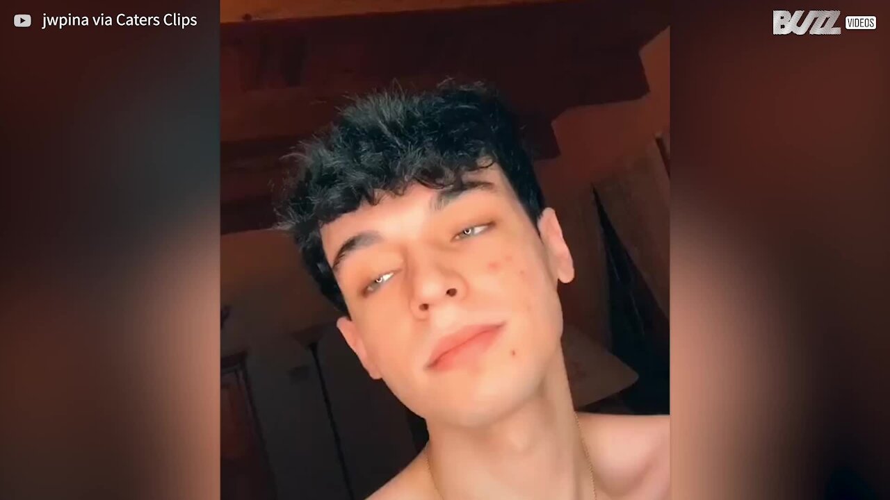 Jovem faz polegar crescer 3 vezes mais que o normal! - 1