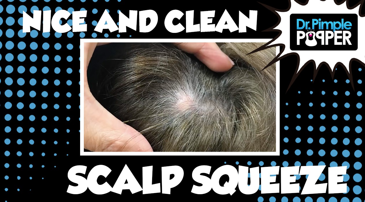 A Nice and Clean Cut Scalp