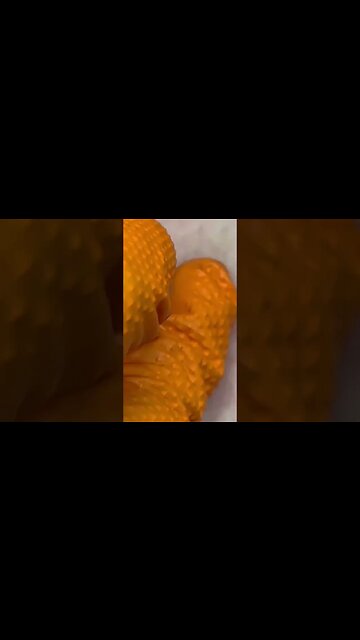 Have You Seen Human Skin Blowouts?