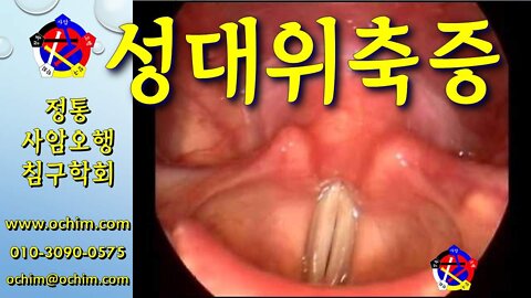 성대위축증 치료 방법 - 비과학적 양의학 198 - 사암침, 사암침법, 정통사암침