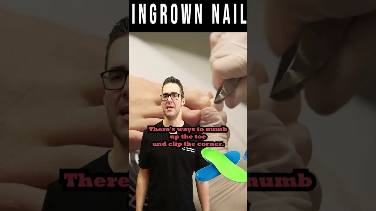 How to get RID of an Ingrown Toenail [ Ingrown Toenail Removal]