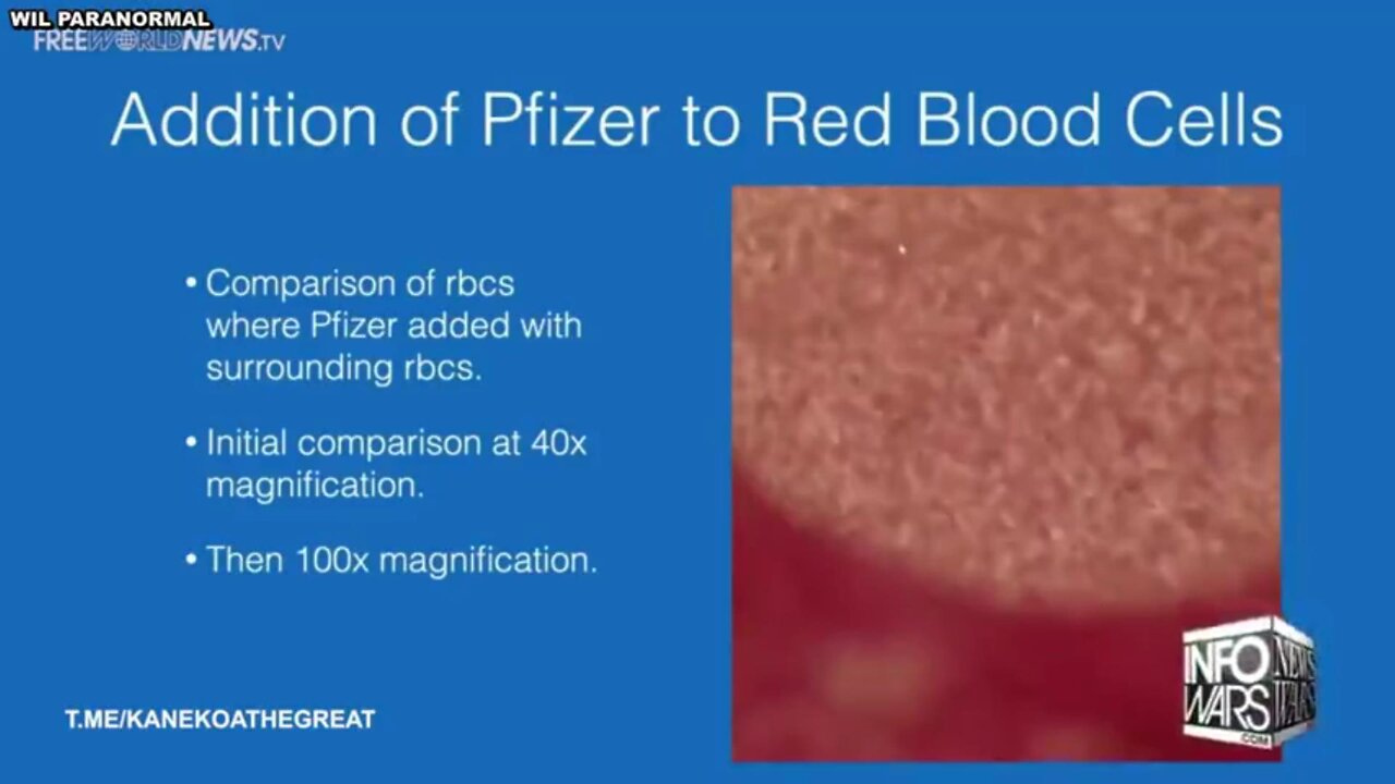 The Pfizer Vaccine Clots Your Blood in Under a Minute