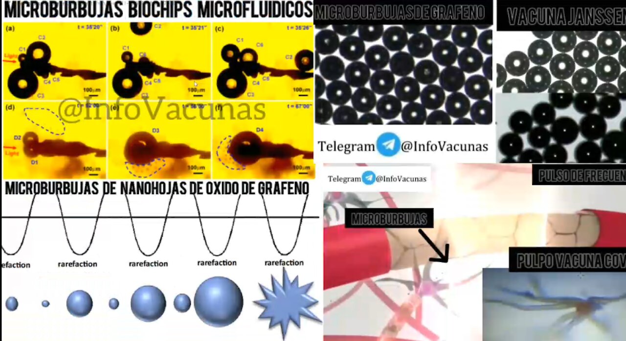 Microburbujas de grafeno en las vacunas COVID 19 serán las causantes de la pandemia MARBURG (buja)