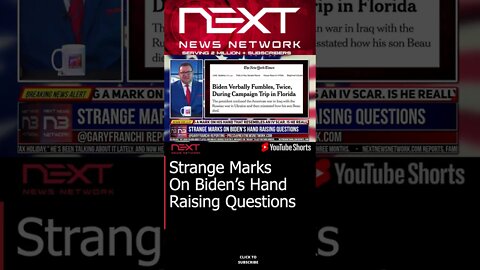 Strange Marks On Biden’s Hand Raising Questions #shorts