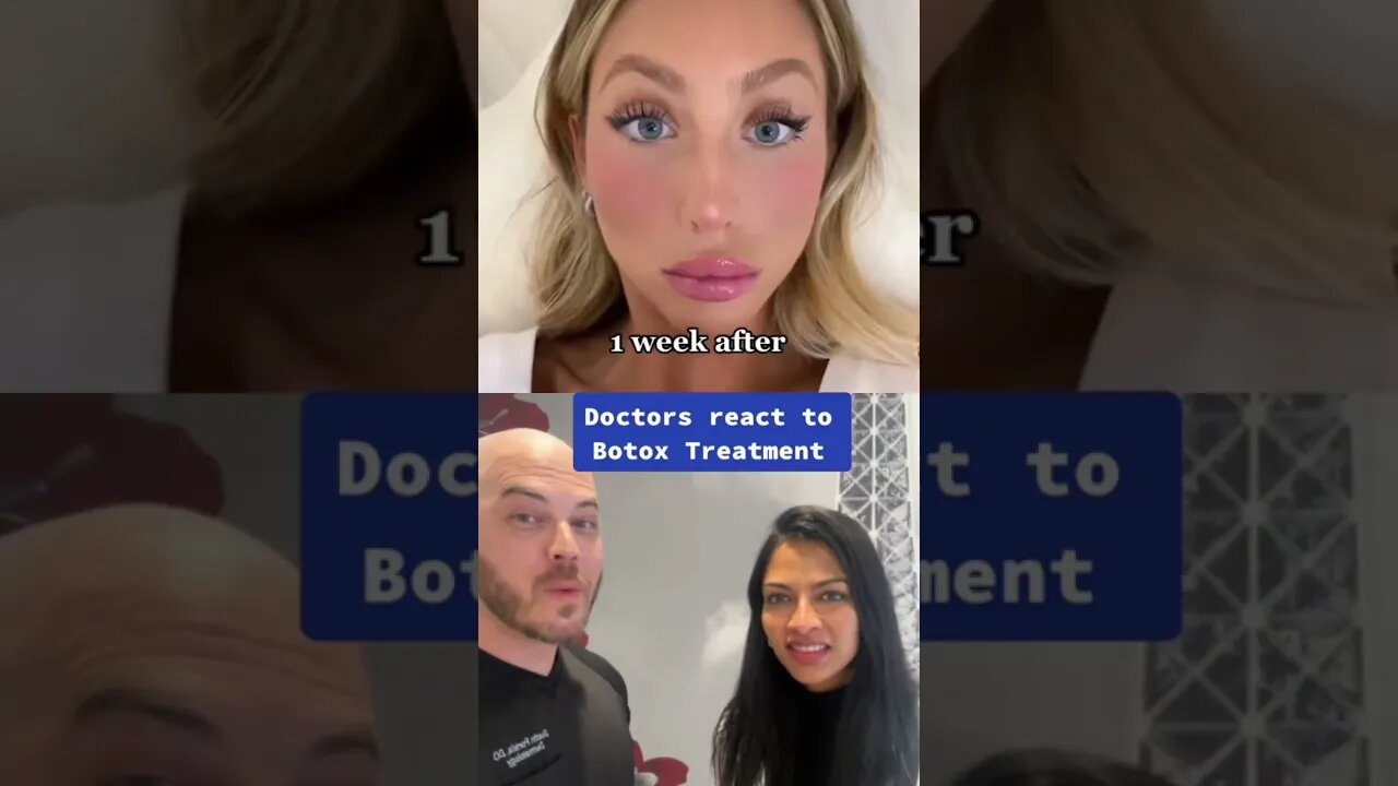 Doctors react to Alix Earle’s botox treatment! #botox