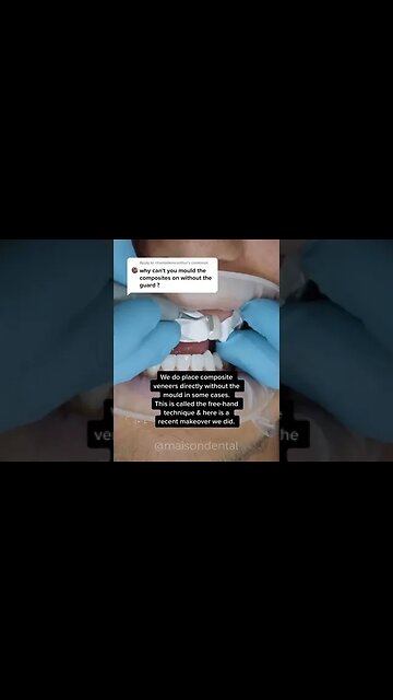 Dental And Teeth Hygiene