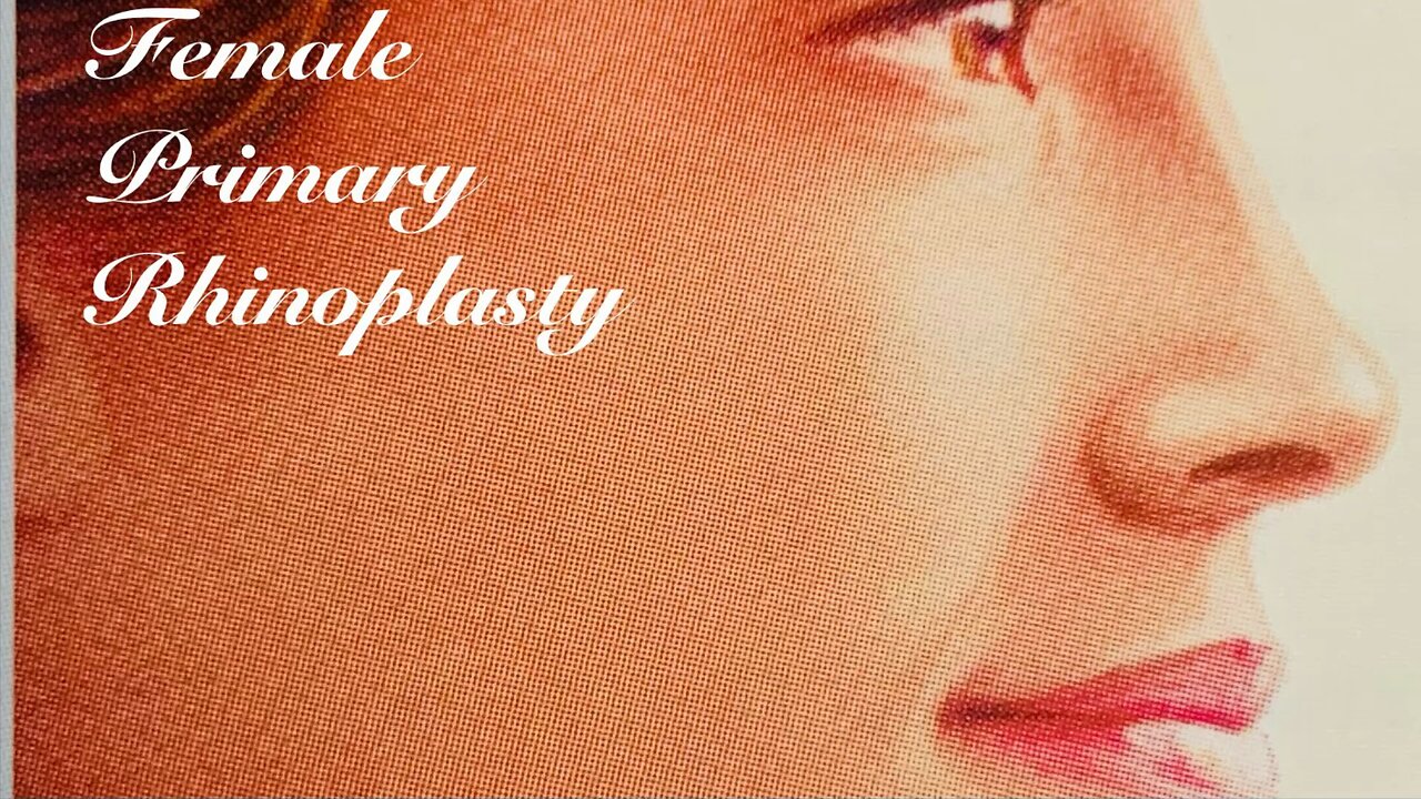 Female primary rhinoplasty