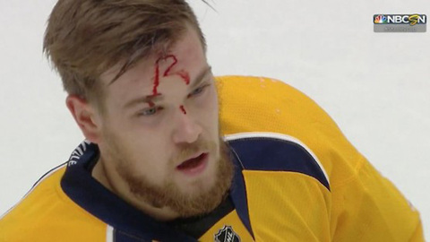 Nick Ritchie Leaves His Signature in Viktor Arvidsson's FOREHEAD After Brutal Boarding Penalty