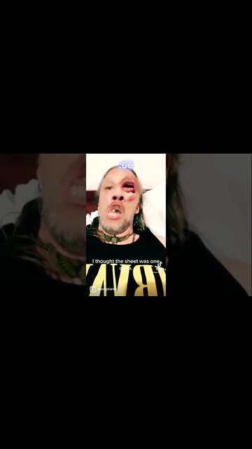 Tripping too hard and this happened…luckily you can video hallucinations.