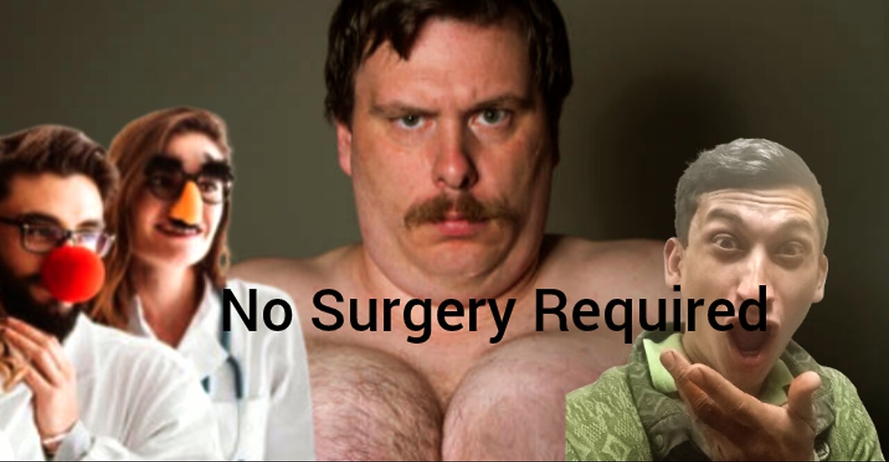 How To Remove Man Boobs Without Surgery Easily