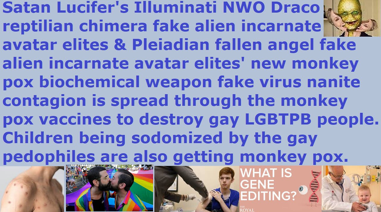 NWO is using AI "black goo" nanobot monkey pox vaccine to spread monkey pox to gay LGBTPB pedophiles