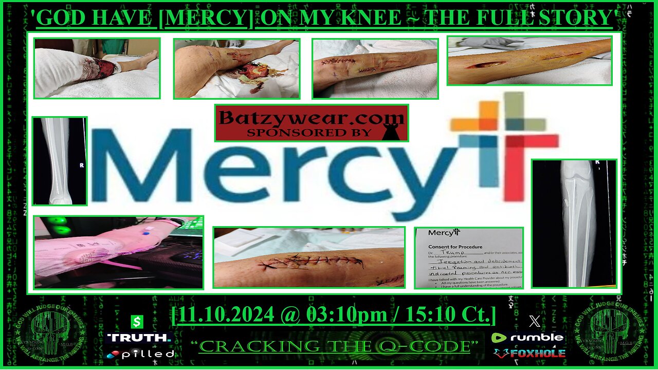 "GOD HAVE [MERCY] ON MY KNEE ~ THE FULL STORY"