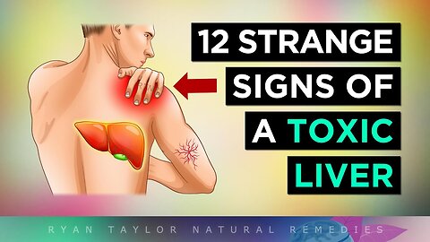 12 Strange Signs Your LIVER Is TOXIC