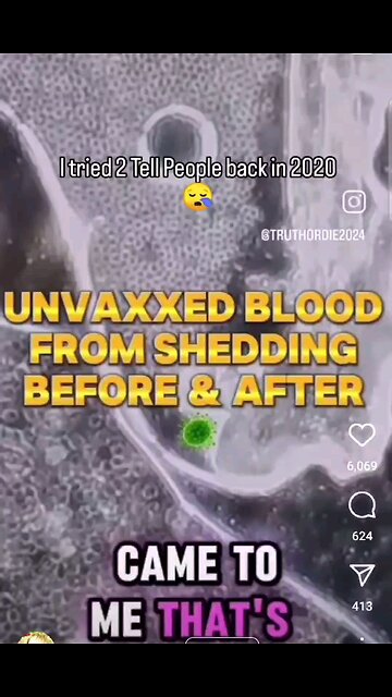 How to Cure Unvaxxed from Vaccination Shedding! MUST WATCH