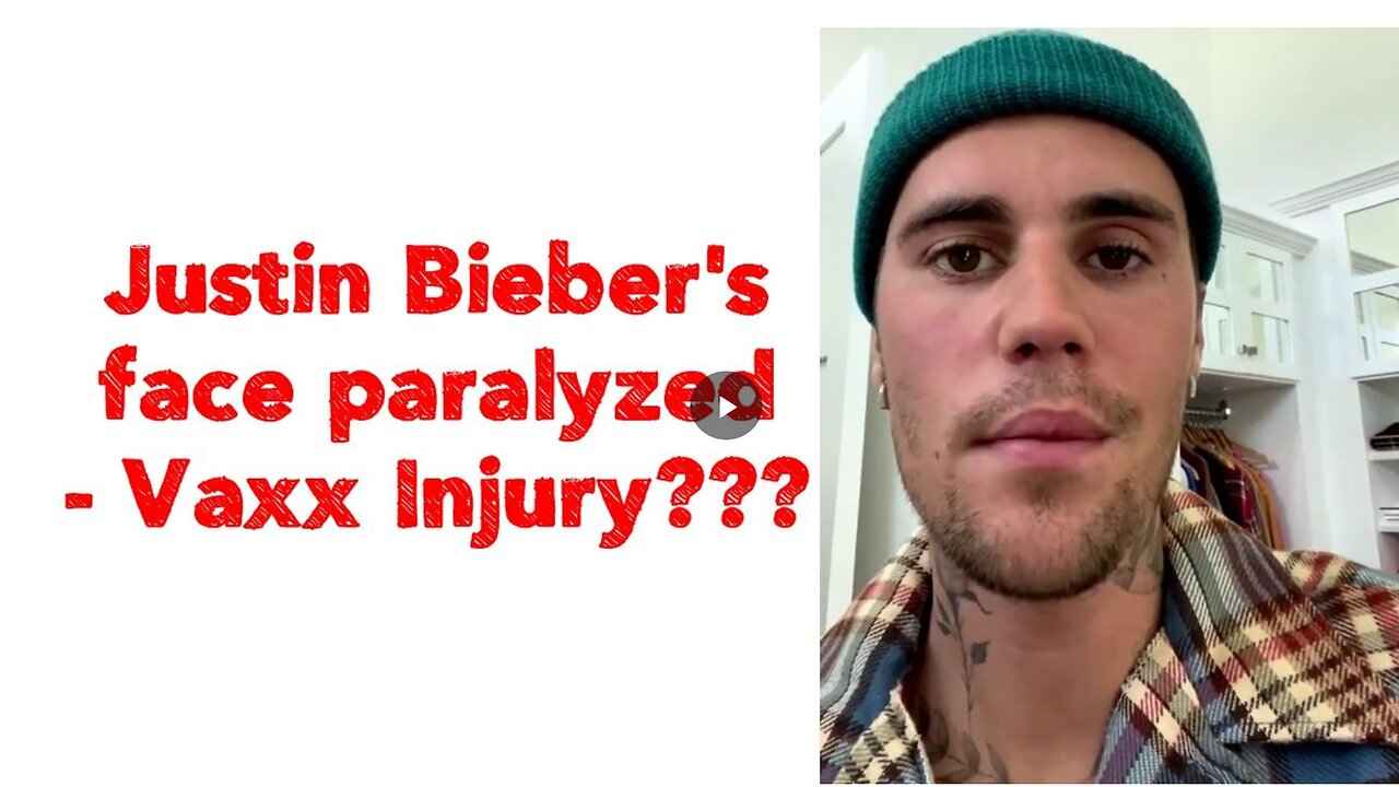 Justin Bieber's face paralyzed - Vaxx Injury???