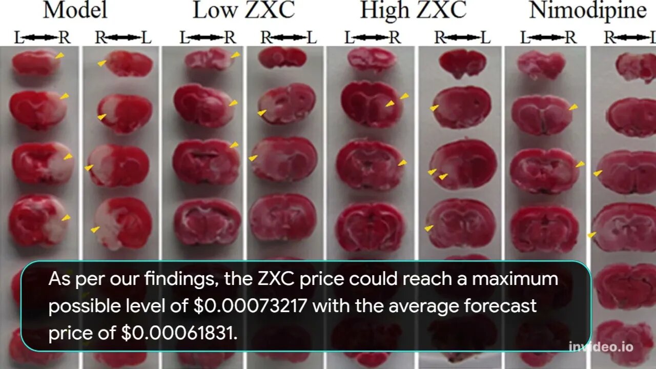 0xcert Price Prediction 2022 2025, 2030 ZXC Price Forecast Cryptocurrency Price Prediction