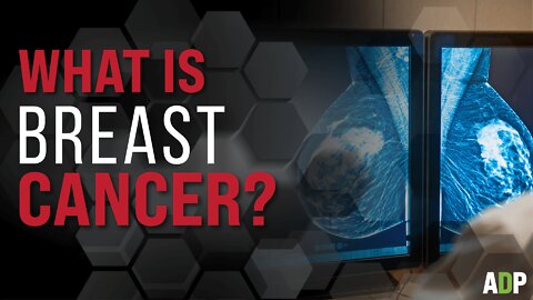 What is Breast Cancer