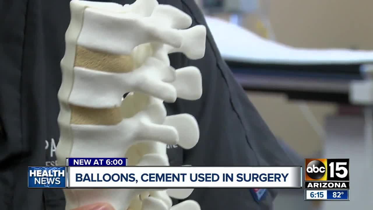 Spinal surgery using balloons and cement helps Valley woman stay active