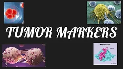 Tumor Markers of Different Types of Cancer: Diagnosis & Significance | Novice Medic