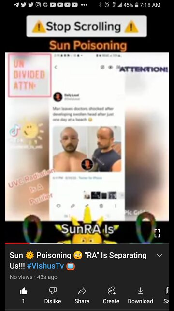 Sun 🌞 Poisoning "RA" Is Separating Us!!! #VishusTv 📺