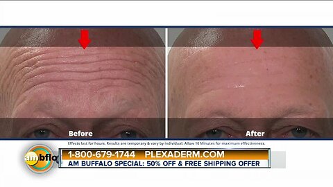 Plexaderm - March 30 2020