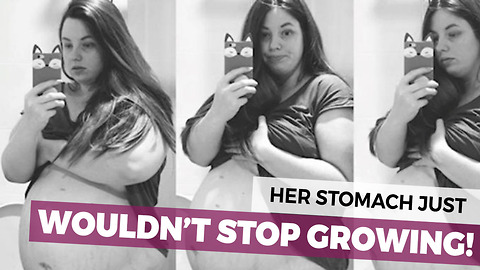 They Had No Idea THIS Would Happen When She Got Pregnant Again..