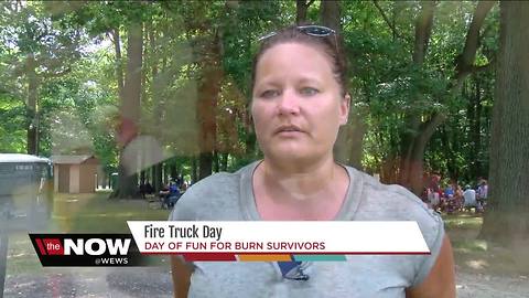 Burn survivors get a day of fun with firefighters