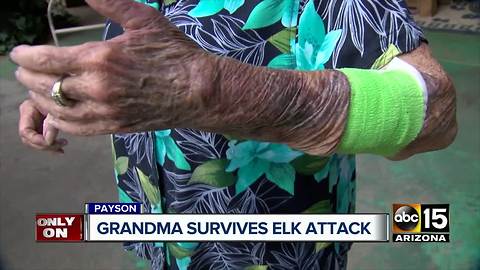 Payson grandmother attacked by mother elk