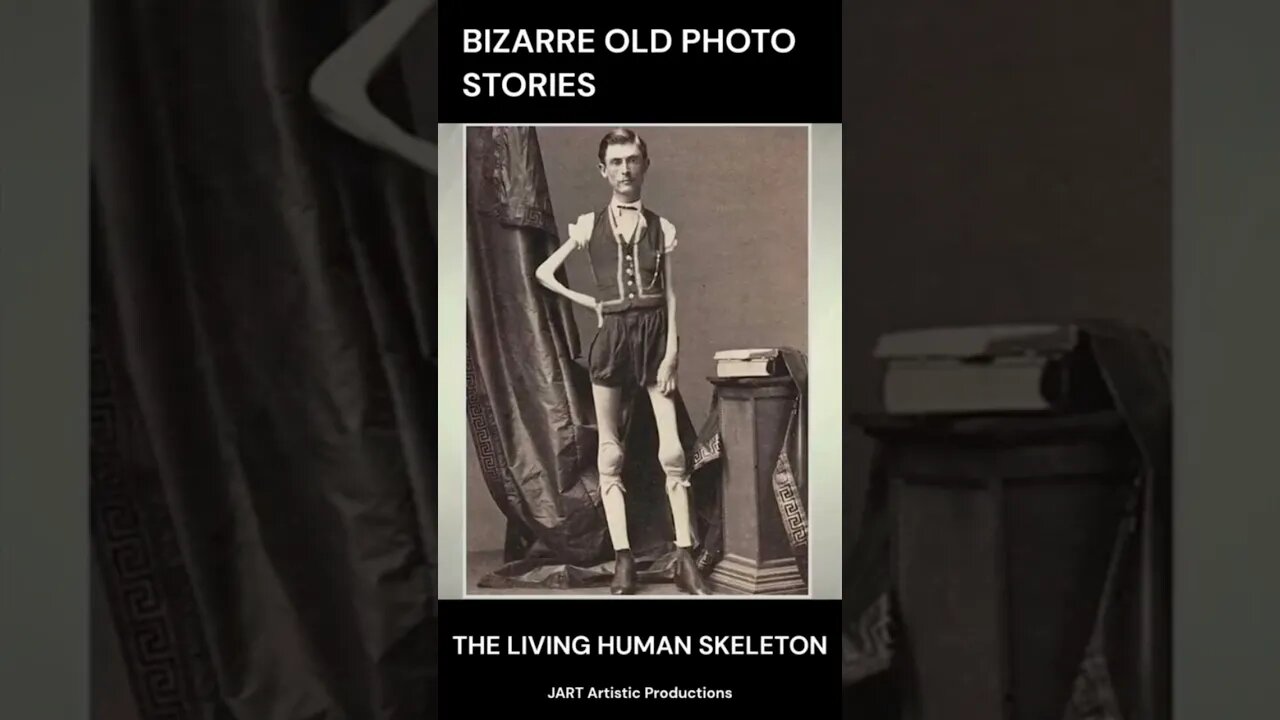 THE LIVING HUMAN SKELETON - Bizarre Ancient Photo Stories