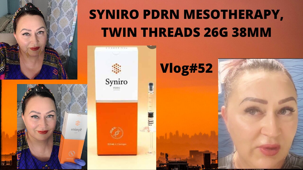 SYNIRO MESOTHERAPY , PDO THREADS 26G 38MM VLOG#52! #pdothreads#syniropdrn. 11 06 21