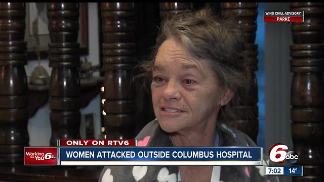 Woman describes being attacked during attempted carjacking outside Columbus hospital