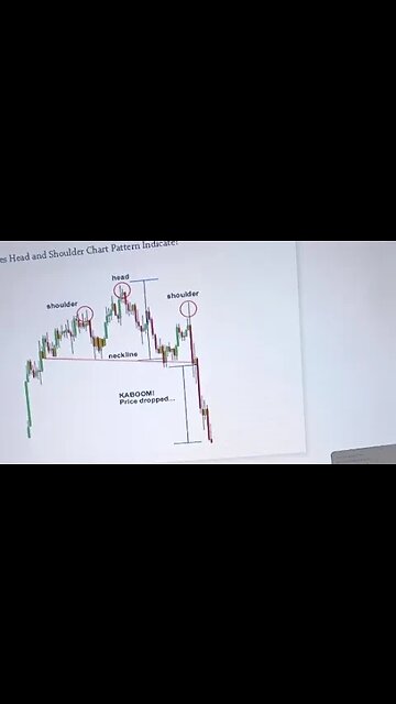 Head And Shoulder| Forex Trading