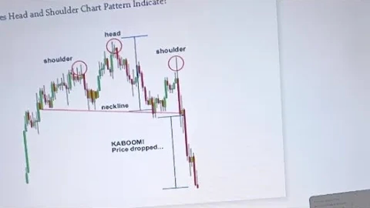 Head And Shoulder| Forex Trading