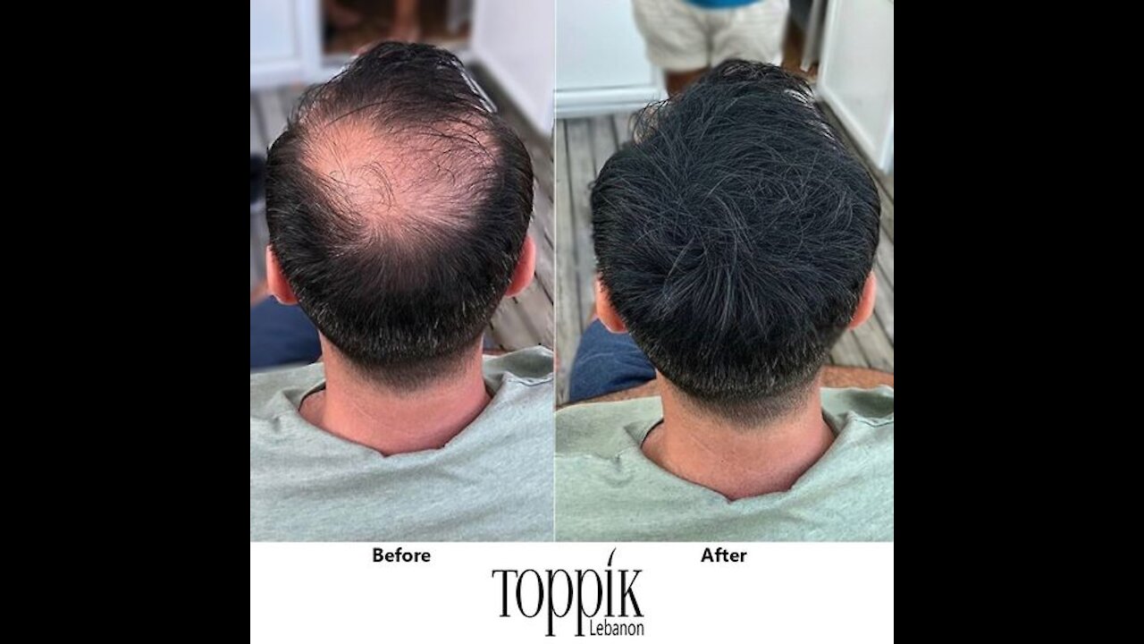 Toppik Hair Fibers لفراغات الشعر