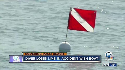 Diver loses an arm in accident with boat off Palm Beach